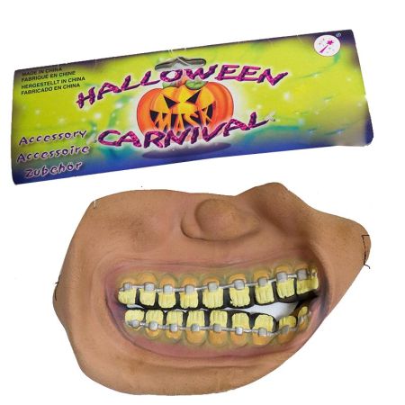 Boca Grande Com Aparelho